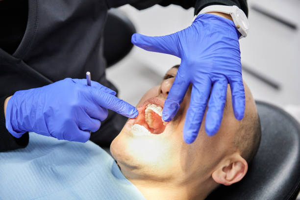 Best Dentist for Tooth Abscess  in Gardnertown, NY